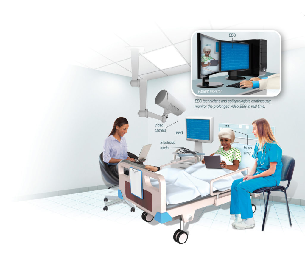 In Sight Two Stage Surgery for Epilepsy Pediatrics Nationwide