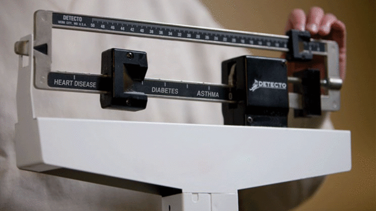 scale