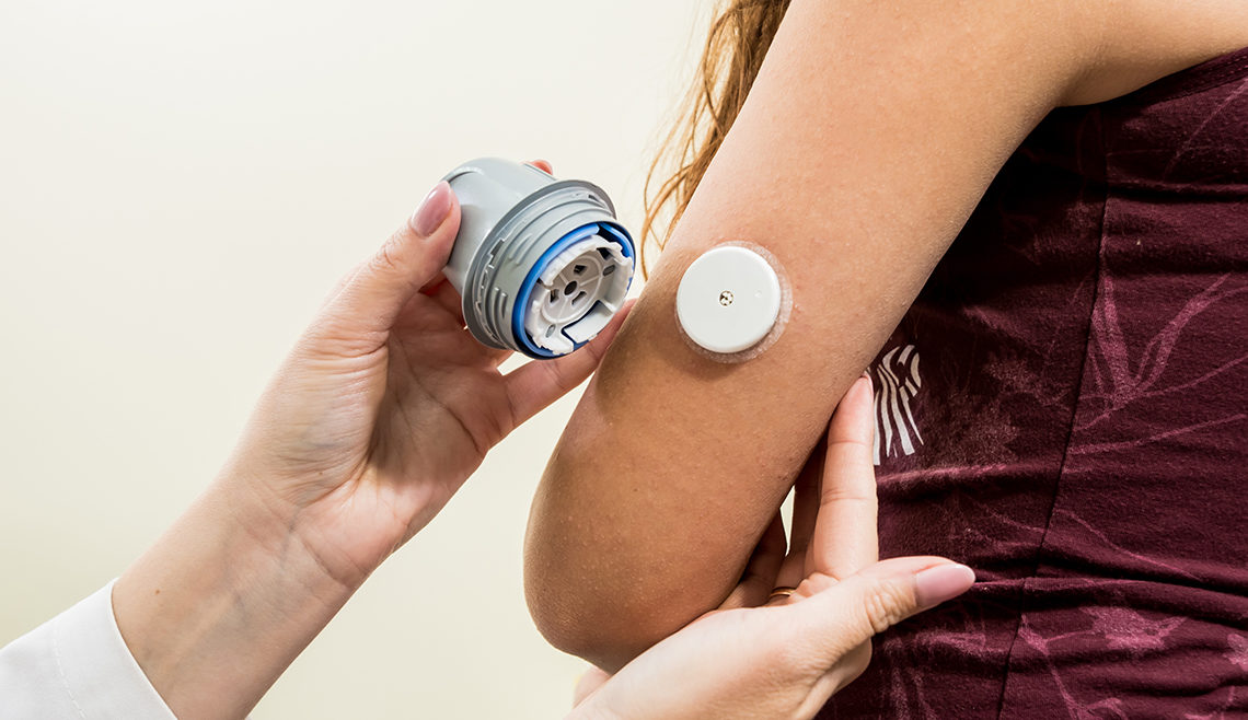 Device for monitoring glucose placed on girl's arm