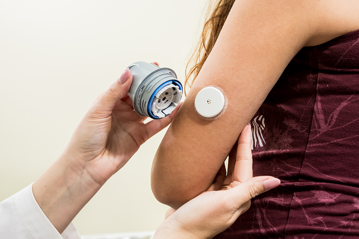 Device for monitoring glucose placed on girl's arm