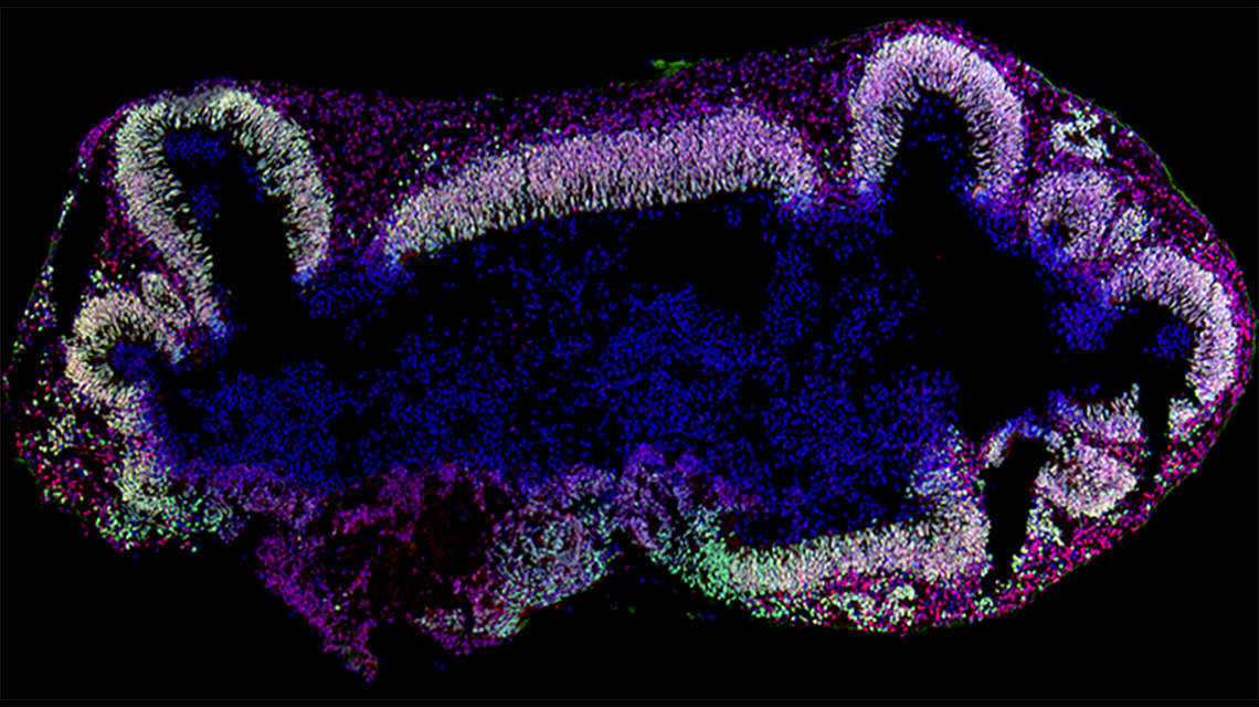 microscopic image of brain organoid