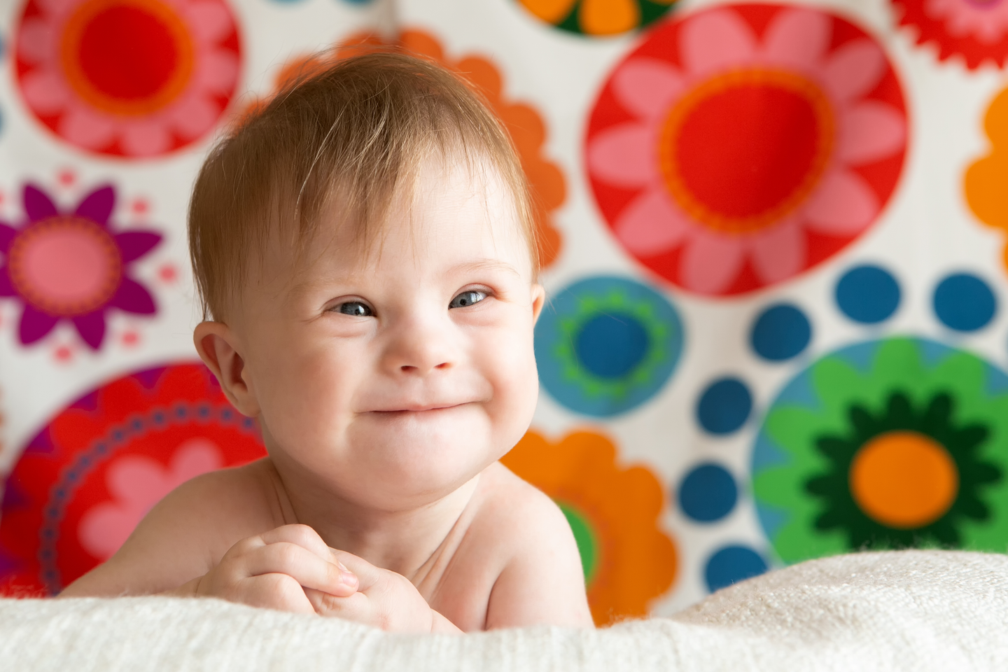 Smiling baby with Down syndrome