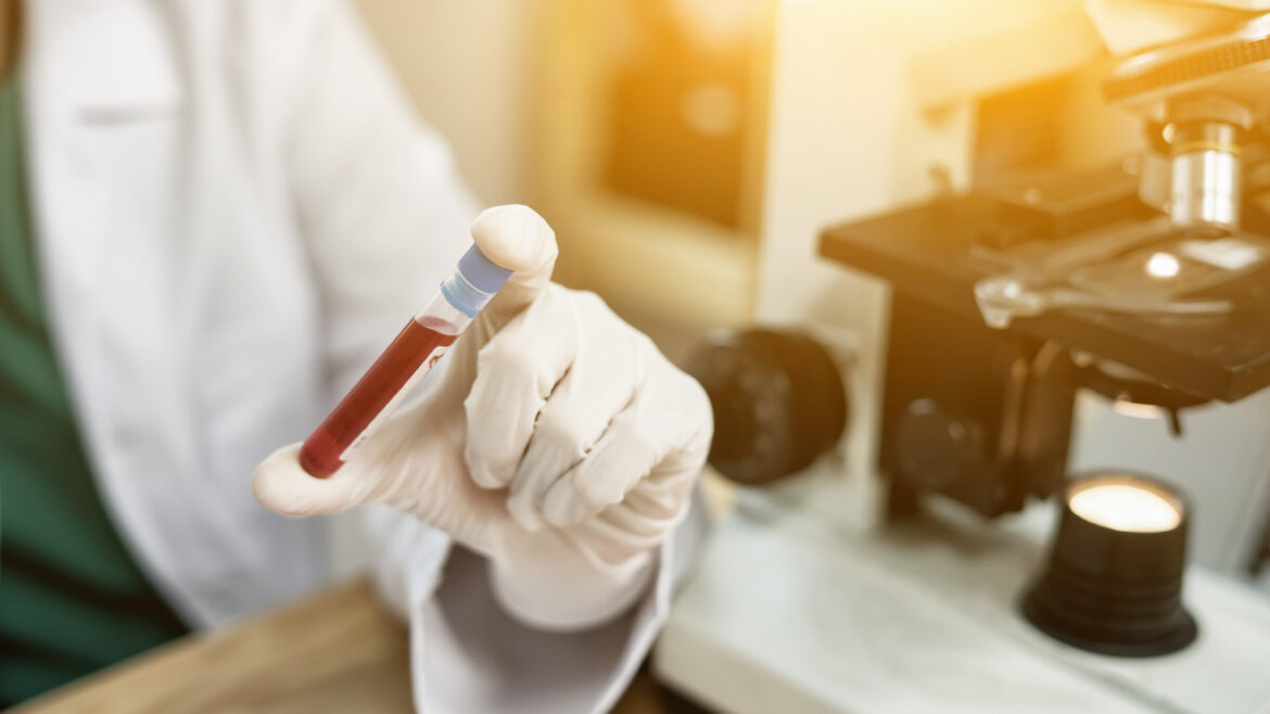 Blood Sample in test tube