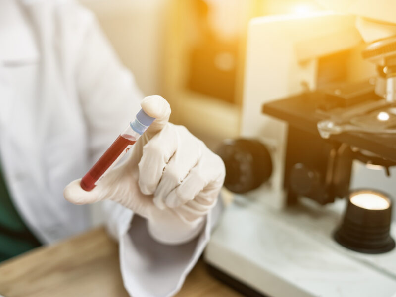 Blood Sample in test tube