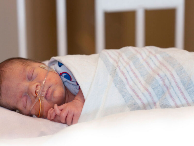 Newborn with bronchopulmonary dysplasia sleeping in a NICU crib, wrapped in a hospital blanket and receiving oxygen through a nasal cannula.