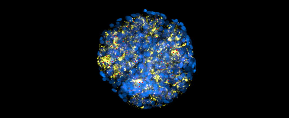 microscopy image of podocytes, a type of cell found in the kidney, stained with blue and fluorescent yellow. small red dots mark the cell