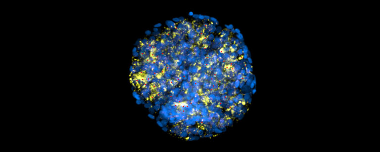 microscopy image of podocytes, a type of cell found in the kidney, stained with blue and fluorescent yellow. small red dots mark the cell