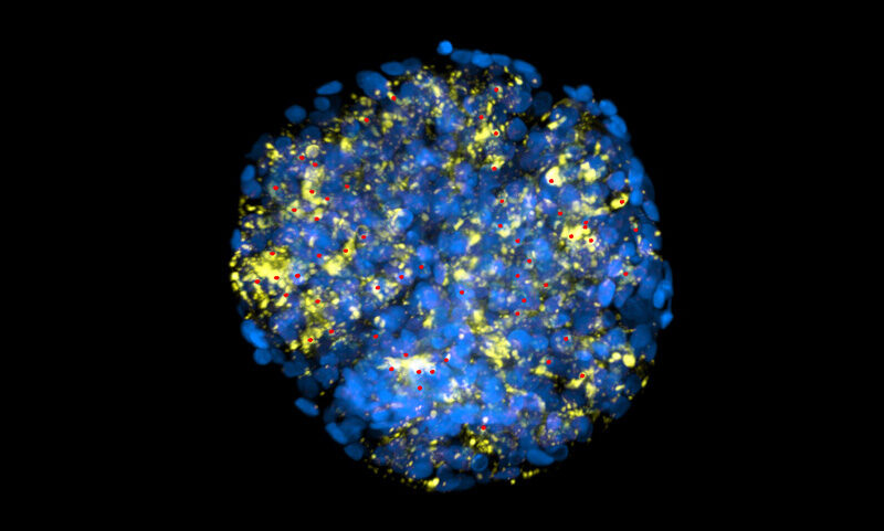 microscopy image of podocytes, a type of cell found in the kidney, stained with blue and fluorescent yellow. small red dots mark the cell