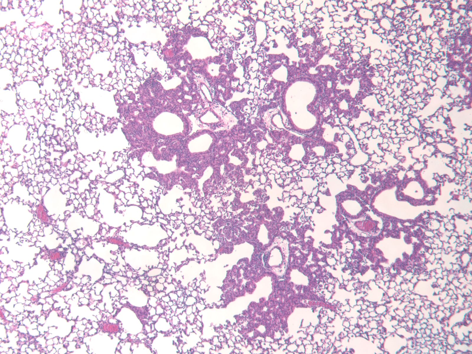 Microscopy image of lung immunohistochemistry of mouse lung infected with Sendai virus.