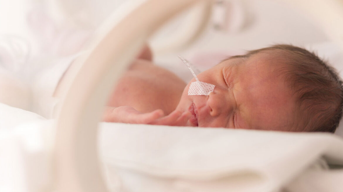 Newborn baby in an NICU bed with a nasogastric tube.