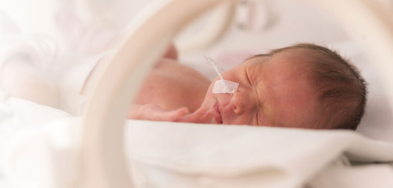 Newborn baby in an NICU bed with a nasogastric tube.