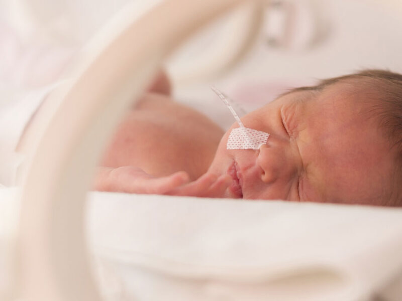 Newborn baby in an NICU bed with a nasogastric tube.