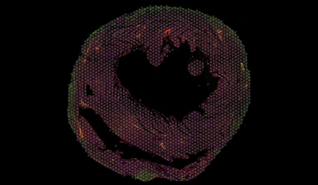 Microscopy image of a mouse heart sample colored with red and green fluorescent dye, and marked for single-cell sampling.