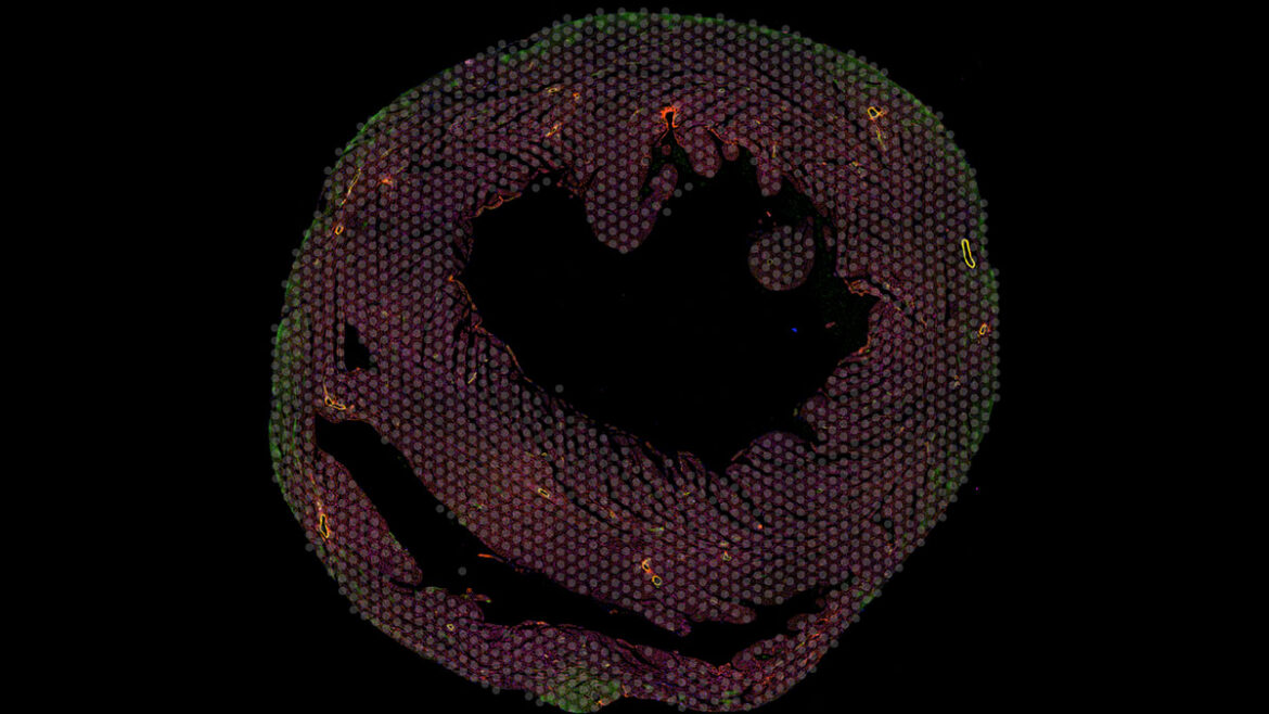 Microscopy image of a mouse heart sample colored with red and green fluorescent dye, and marked for single-cell sampling.