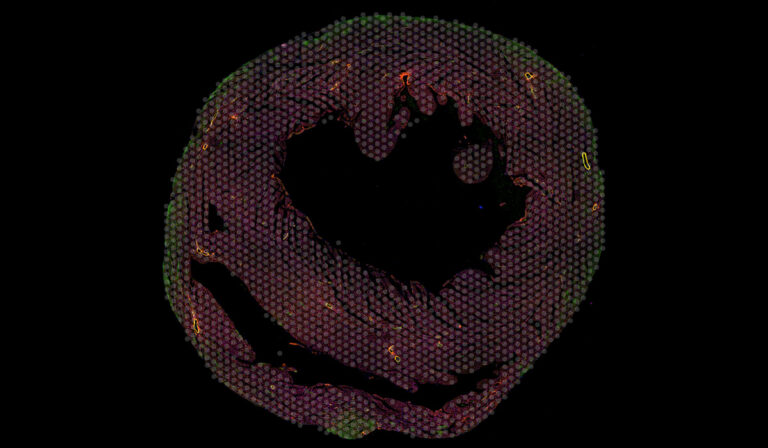 Microscopy image of a mouse heart sample colored with red and green fluorescent dye, and marked for single-cell sampling.