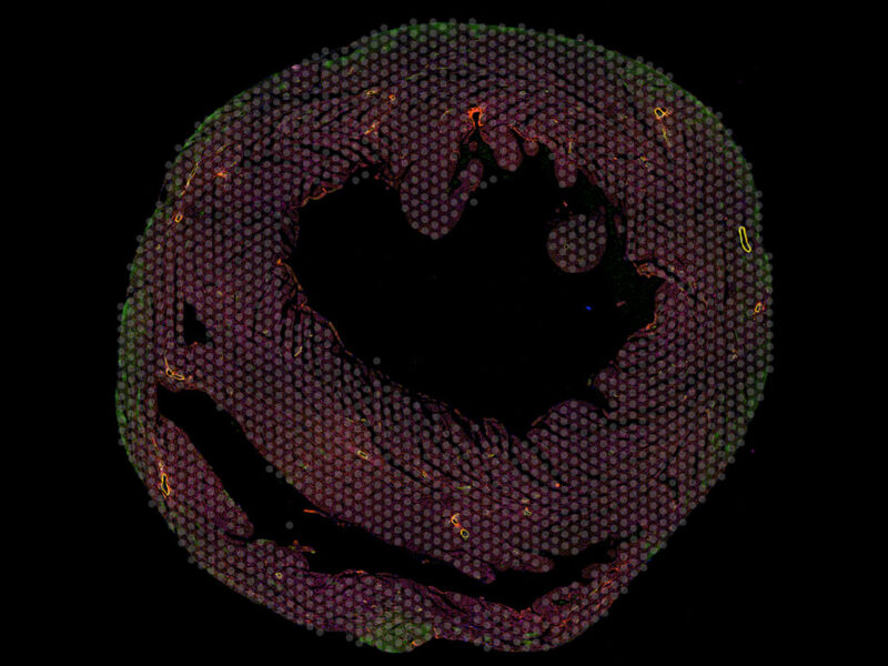 Microscopy image of a mouse heart sample colored with red and green fluorescent dye, and marked for single-cell sampling.