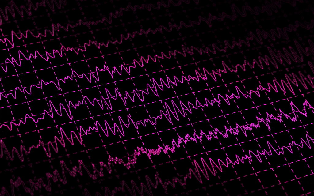 EEG brain waves on black background