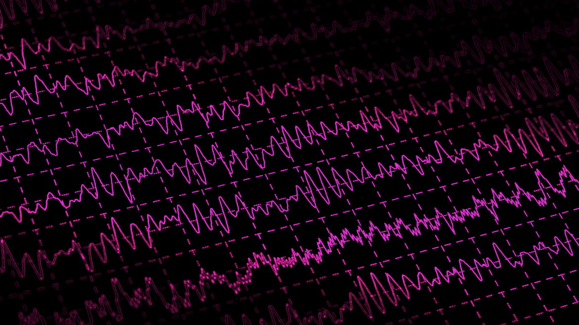 EEG brain waves on black background