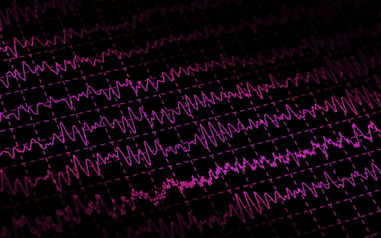 EEG brain waves on black background