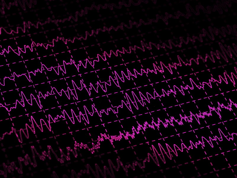 EEG brain waves on black background